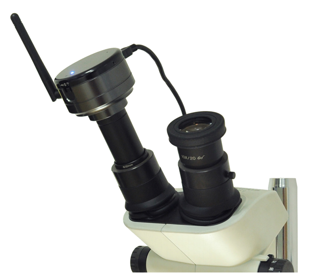 Digital Eyepiece